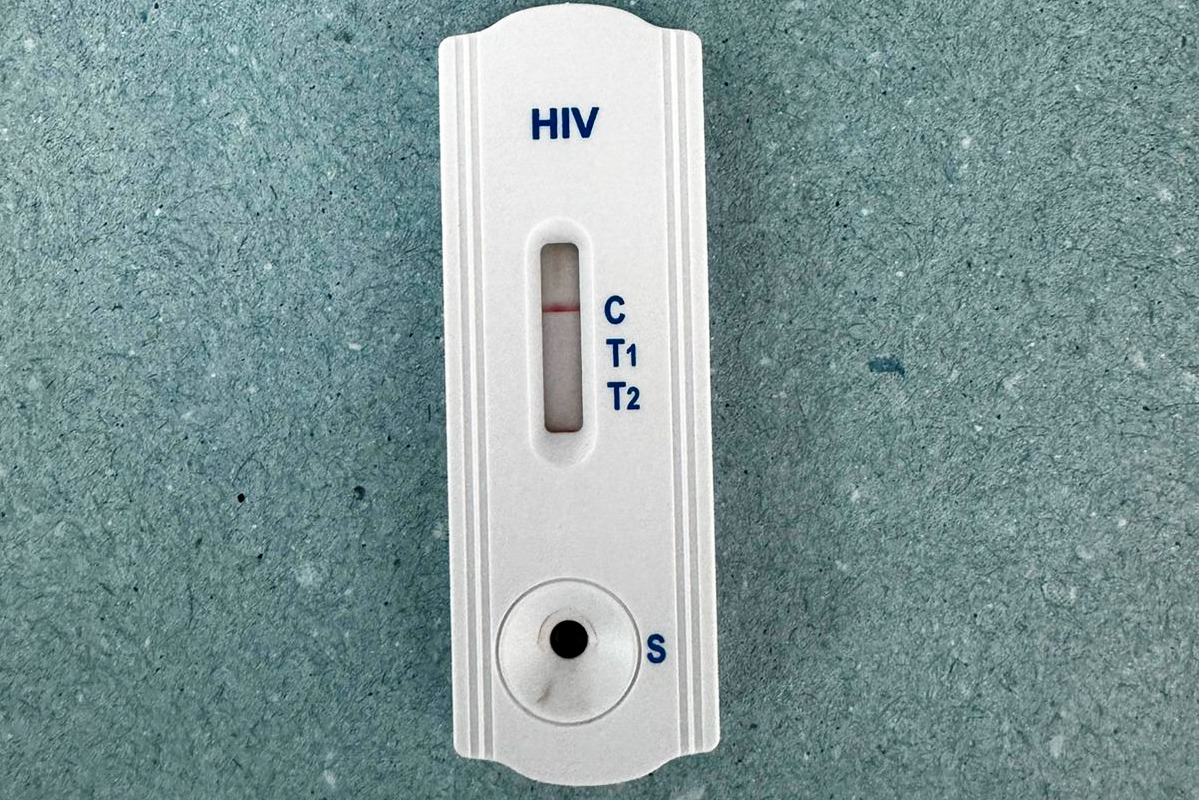 teste HIV