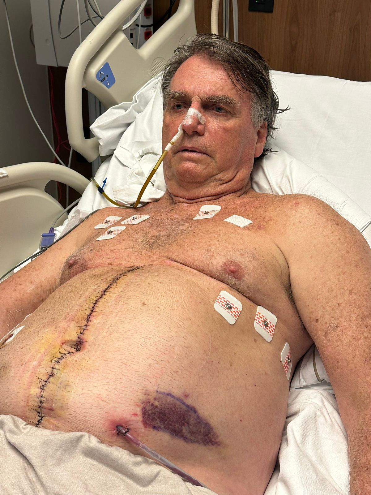 Bolsonaro publica foto e atualiza